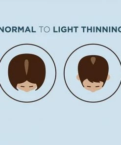 NIOXIN System 1 Scalp & Hair Treatment