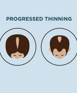 NIOXIN System 2 Scalp Therapy Conditioner PRODUCTS